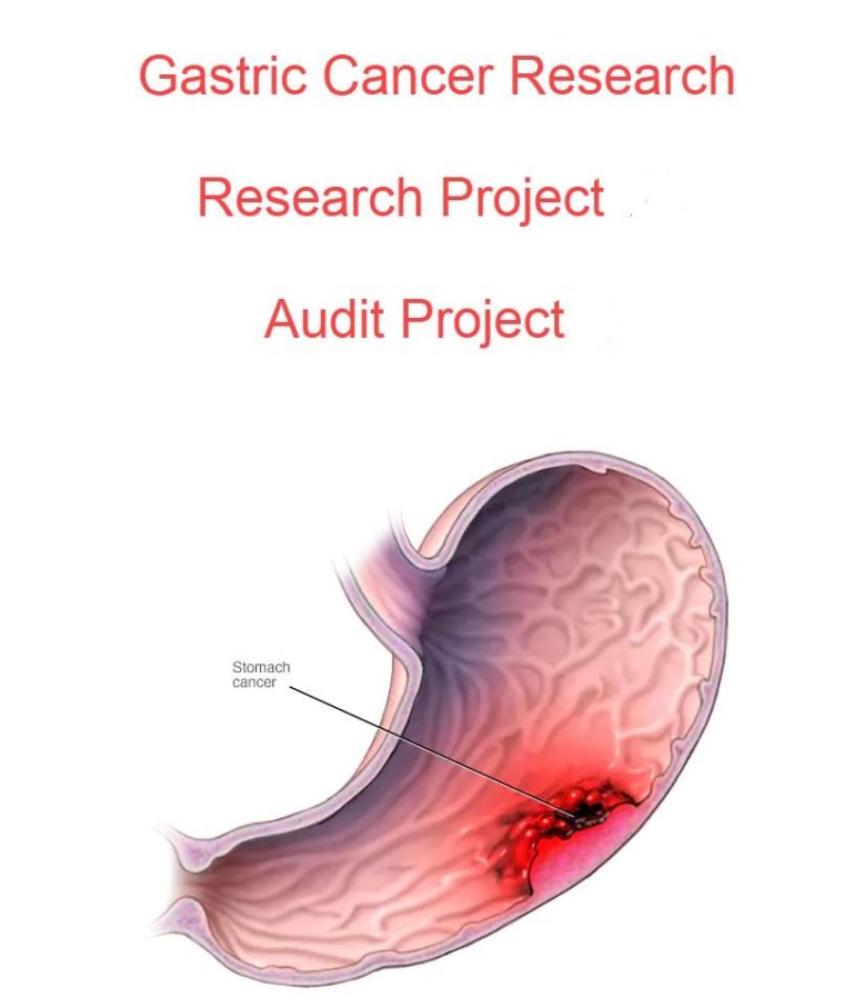 Elective Surgery for Gastric Cancer, RESEARCH AND AUDIT, NEW
