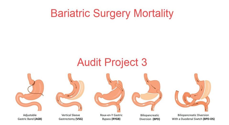 BARIATRIC SURGERY MORTALITY 2024