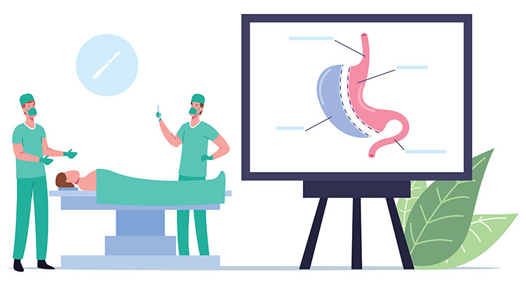 BARIATRIC SURGERY MORTALITY RESEARCH AND AUDIT, NEW 